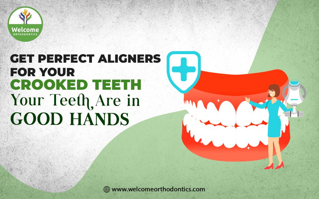 Perfect Aligners