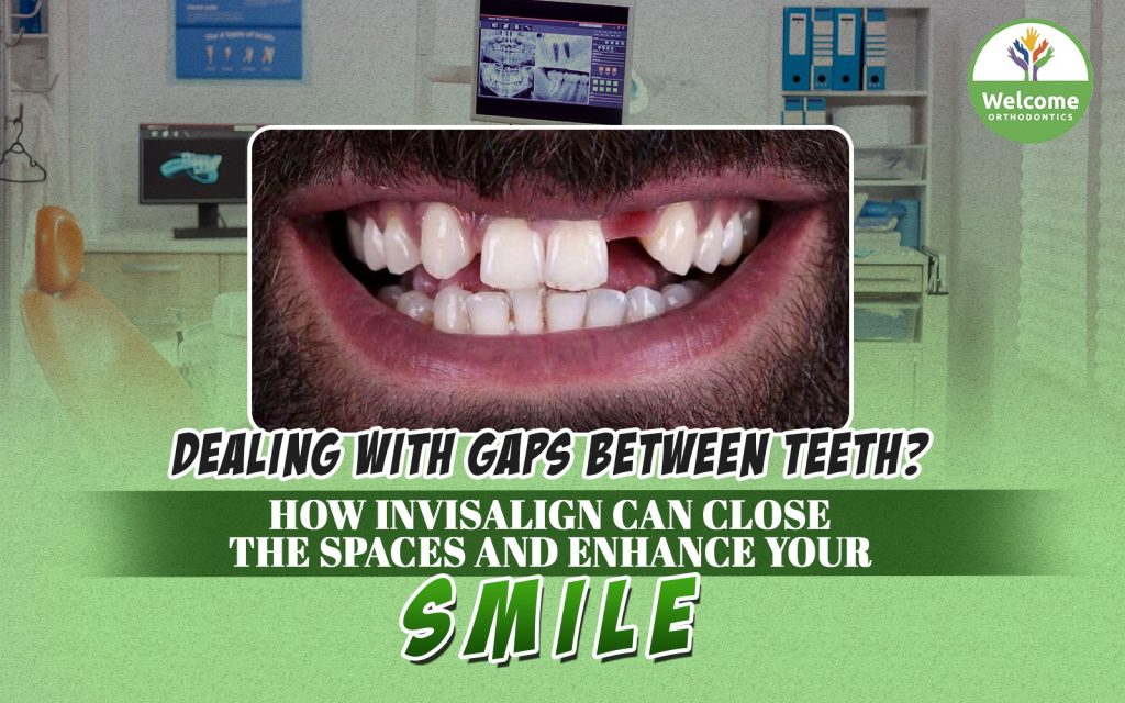 Enhance Your Smile