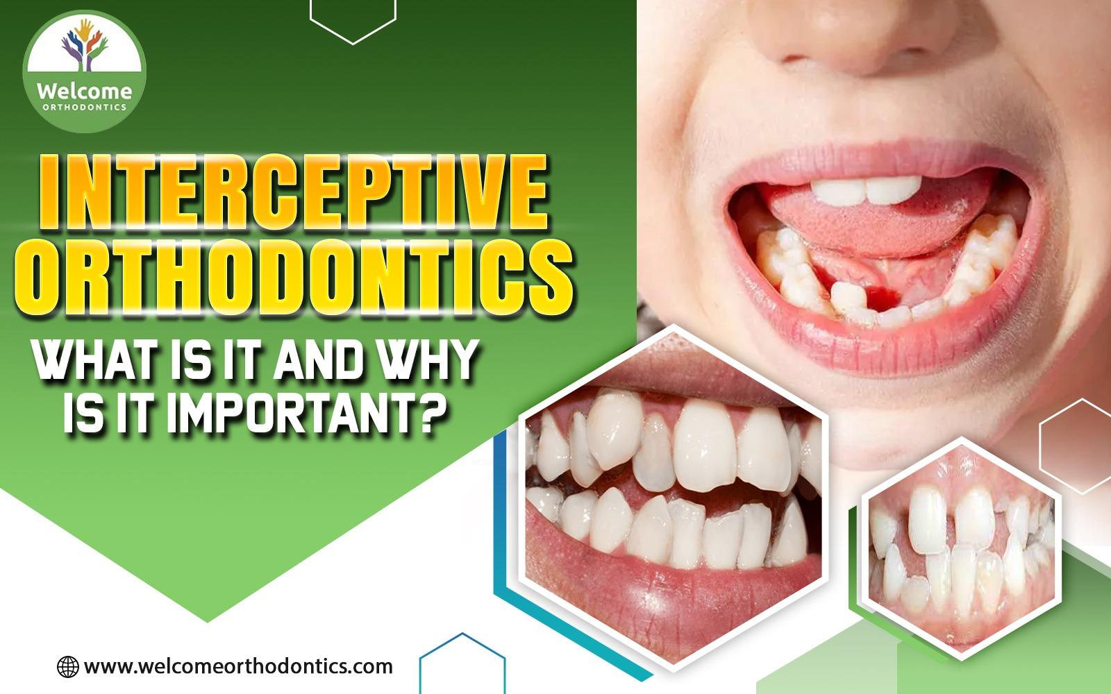 Interceptive Orthodontics: What Is It and Why Is It Important?