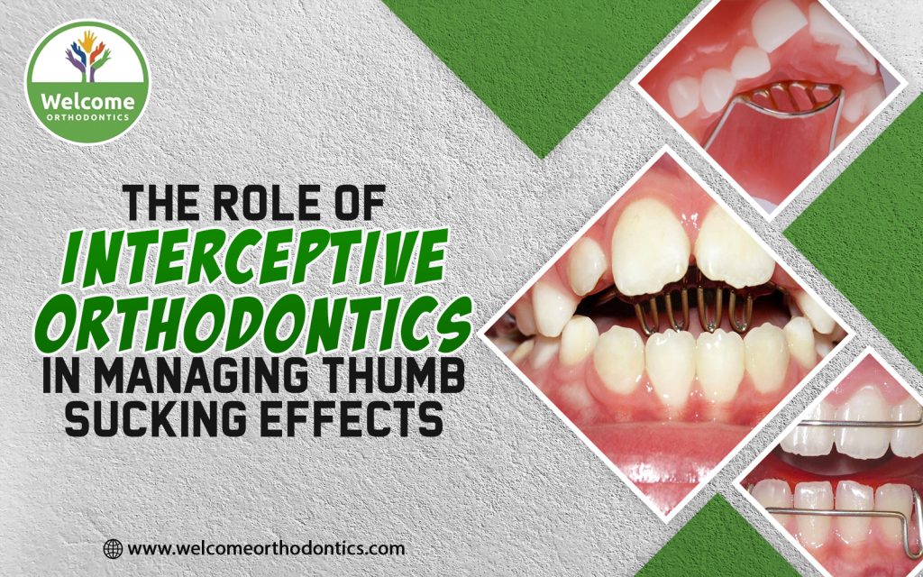 How Interceptive Orthodontics Can Help