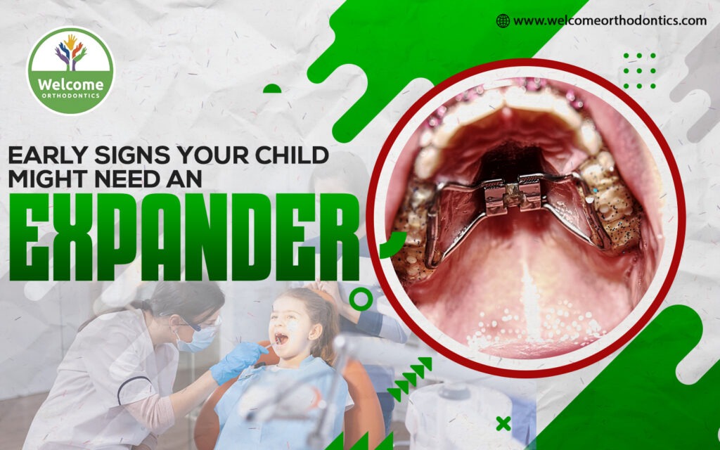 What Is a Palatal Expander?