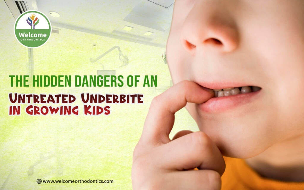 What Exactly is an Underbite?