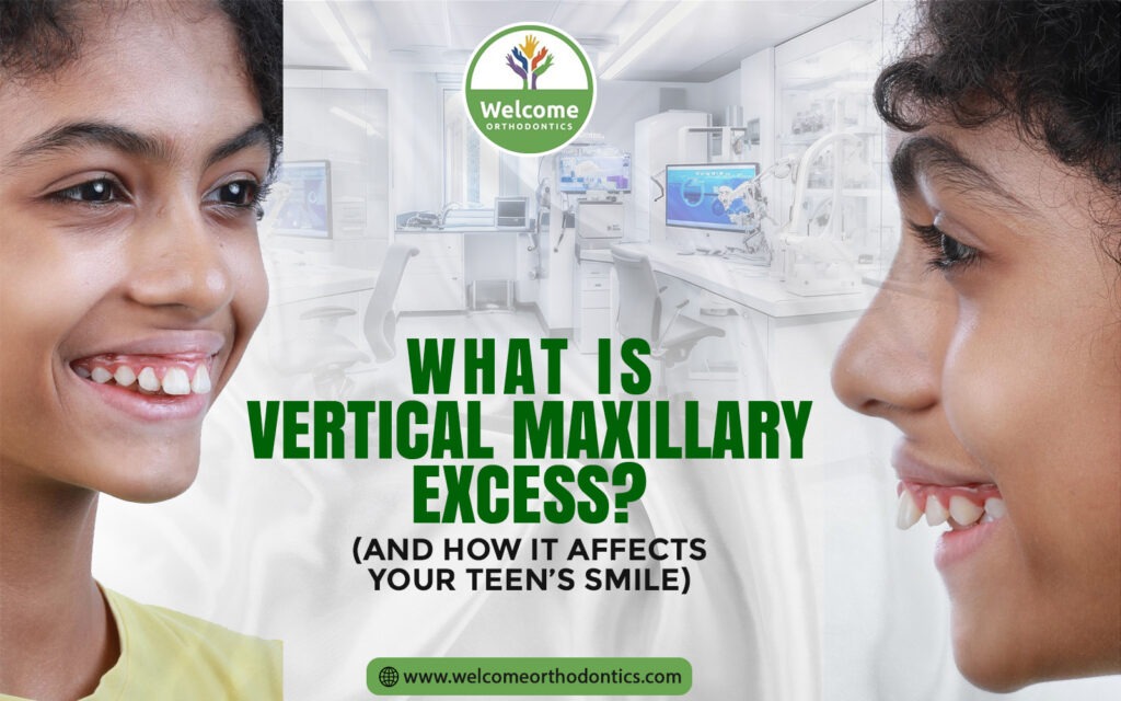What Is Vertical Maxillary Excess?