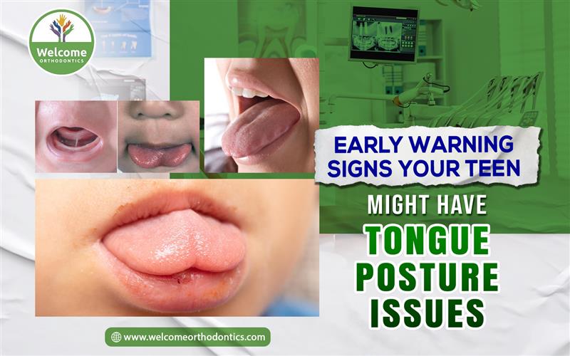 Illustration for Early Warning Signs Your Teen Might Have Tongue Posture Issues
