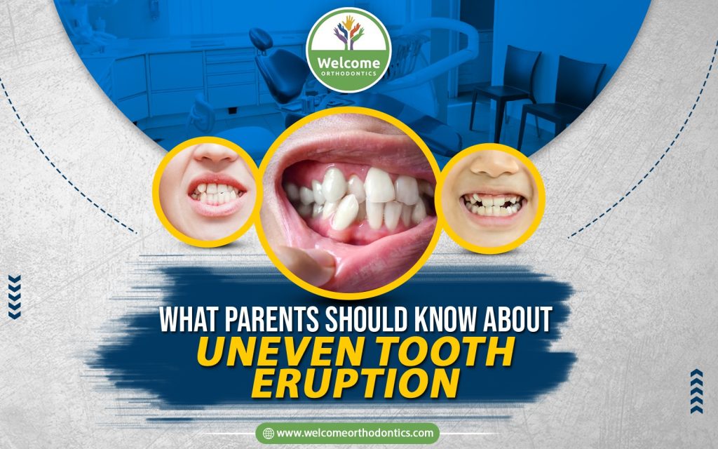 Illustration for What Parents Should Know About Uneven Tooth Eruption