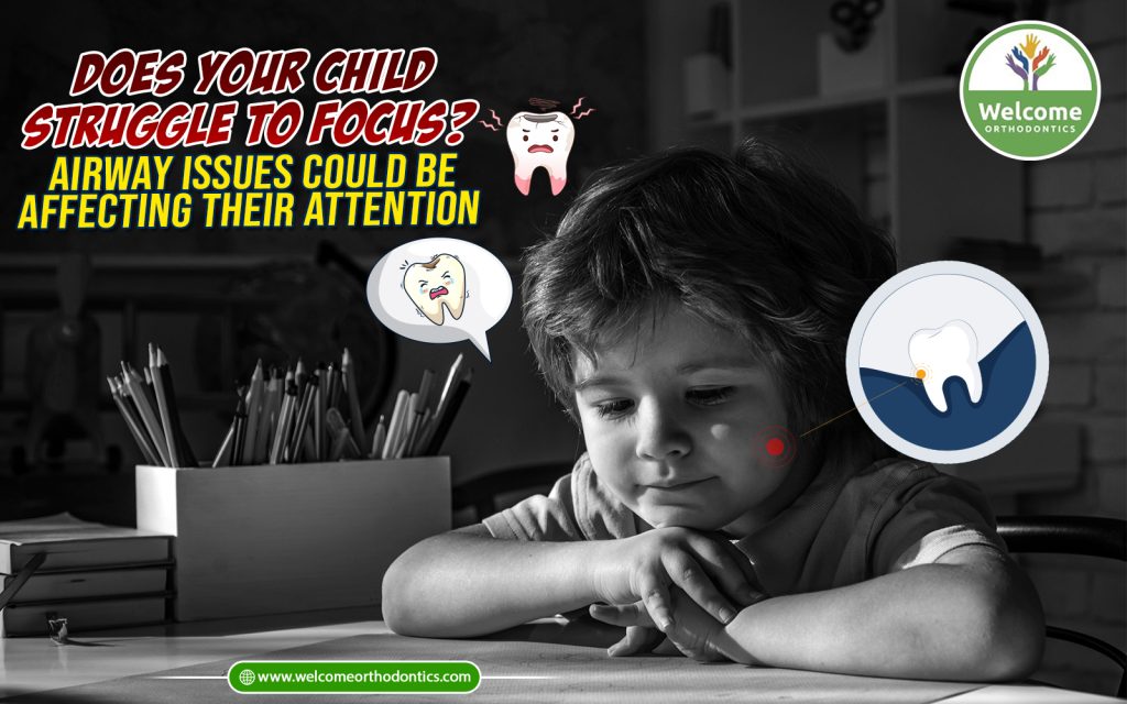 Illustration for Does Your Child Always Have Chapped Lips? Mouth Breathing Could Be the Reason